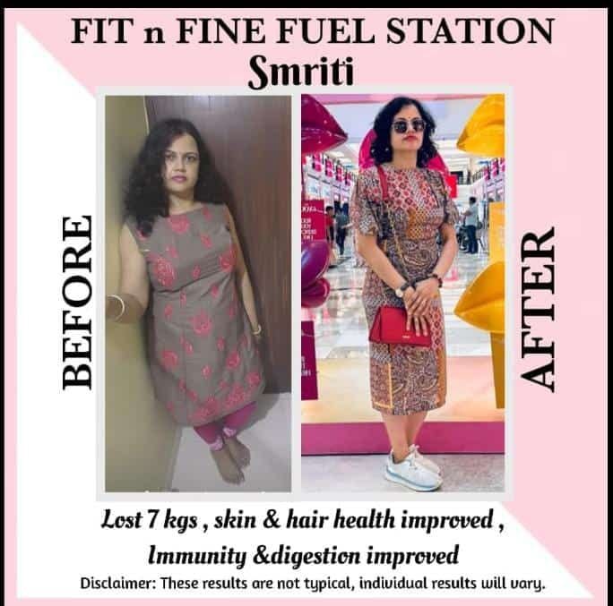 Smriti's transformation - Before and After with Boundless Fitness, lost 7 kgs with improved skin, hair health, immunity and digestion